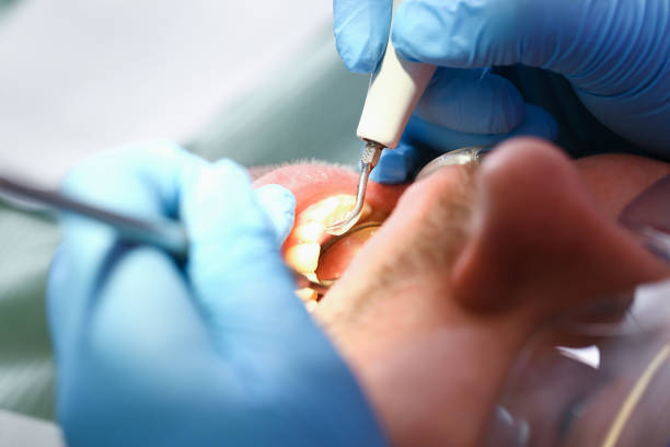 Best Broken Tooth Emergency  in South River, NM